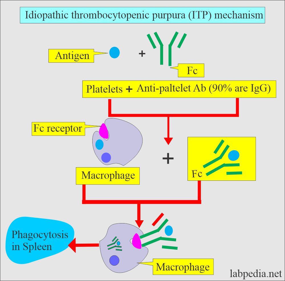 Idiopathic thrombocytopenic purpura (ITP)