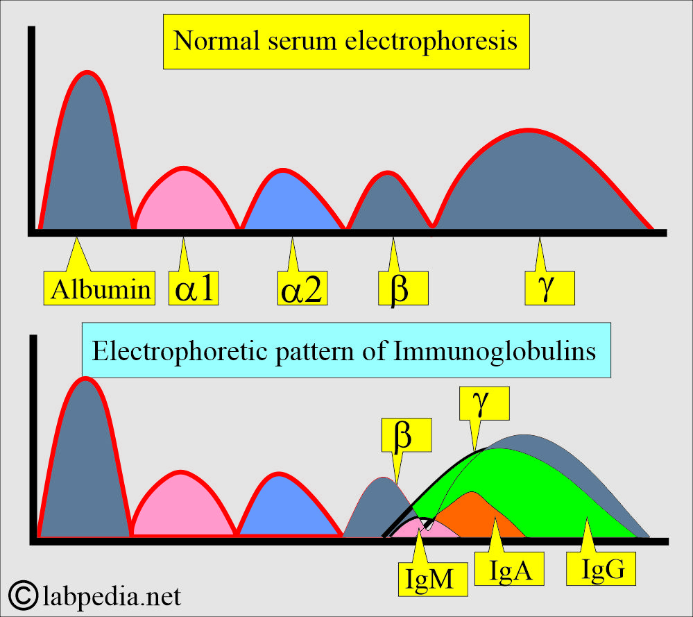 Immunoglobulins electrophoresis Pattern Immunoglobulins electrophoresis Pattern