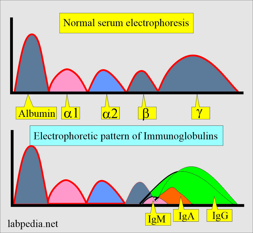 Immunoglobulins electrophoresis pattern