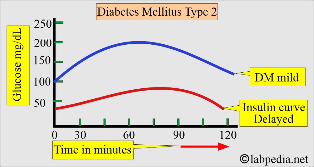 Insulin level in OGTT in DM type 2