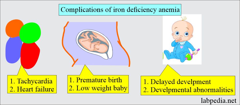 Iron deficiency anemia complications