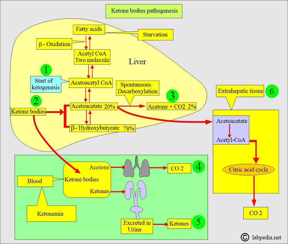 Ketone bodies pathogenesis Ketone bodies pathogenesis