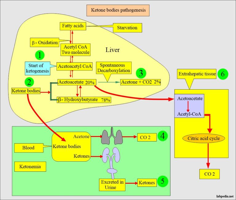 Diabetic Ketoacidosis Ketone Bodies And Management