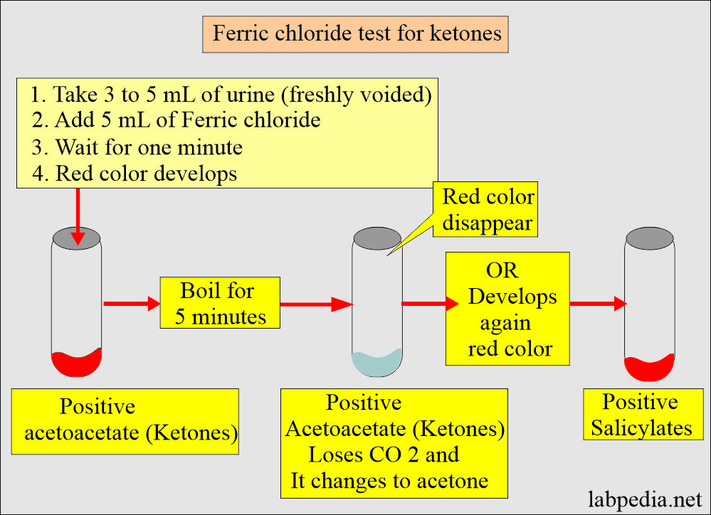  Ferric chloride test for acetoacetate ketone in the urine