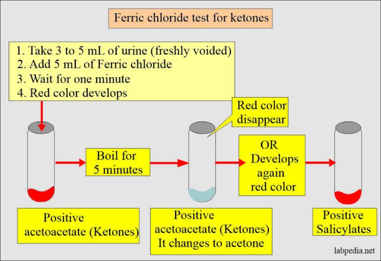 Diabetic ketoacidosis, ketone bodies and management