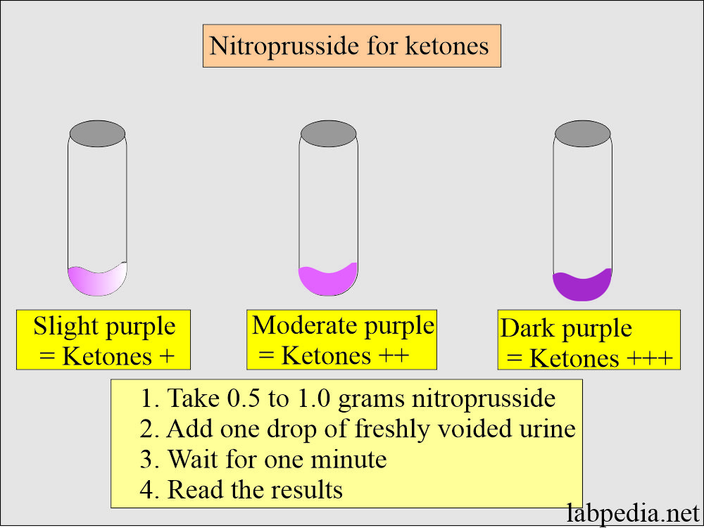 Ketones nitroprusside test in urine