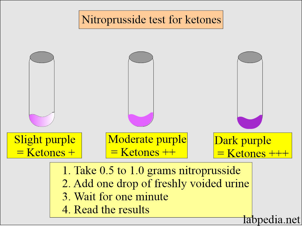 Ketoacidosis diagnosis: Ketones test by nitroprusside reaction