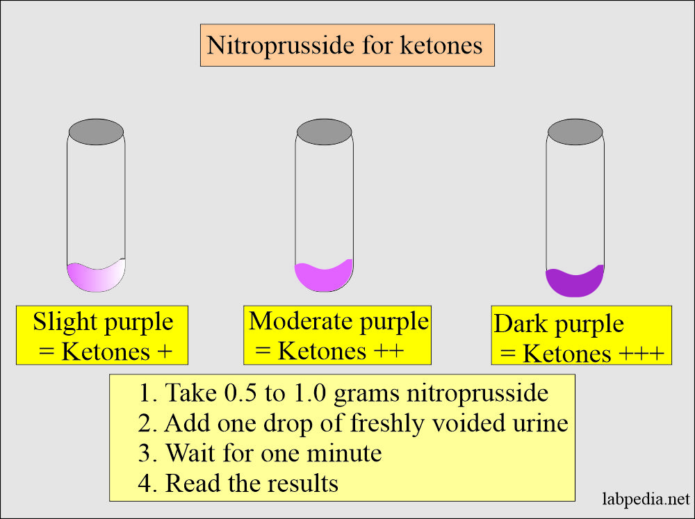 Nitroprusside test for Ketones