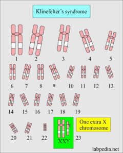 Maternal screening:- Part 2 - Prenatal Screening For Genetic ...