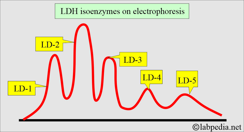 LDH electrophoresis