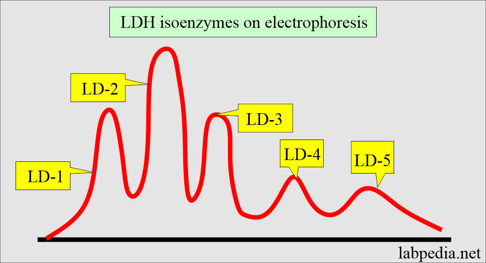Lactate dehydrogenase (LDH) pattern on electrophoresis 