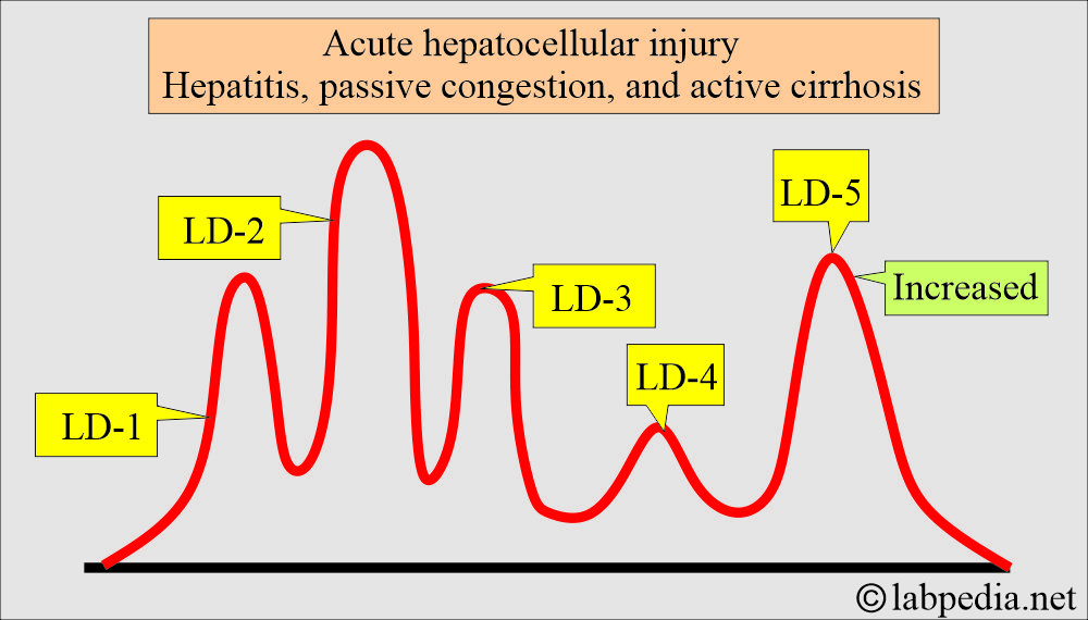 LDH in liver diseases LDH in liver diseases