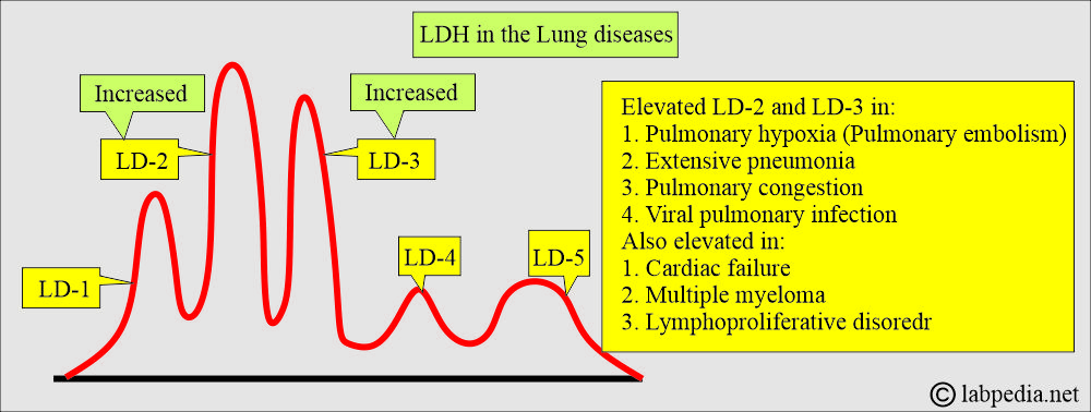 LDH in lung diseases LDH in lung diseases