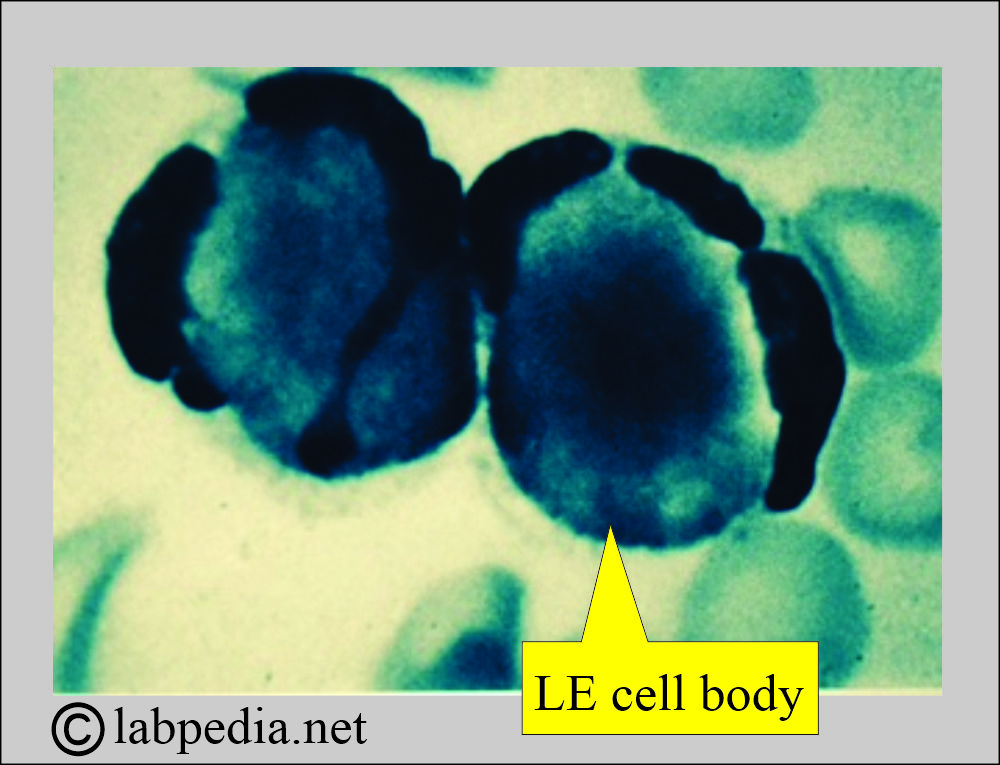 LE Cell Body LE Cell Body