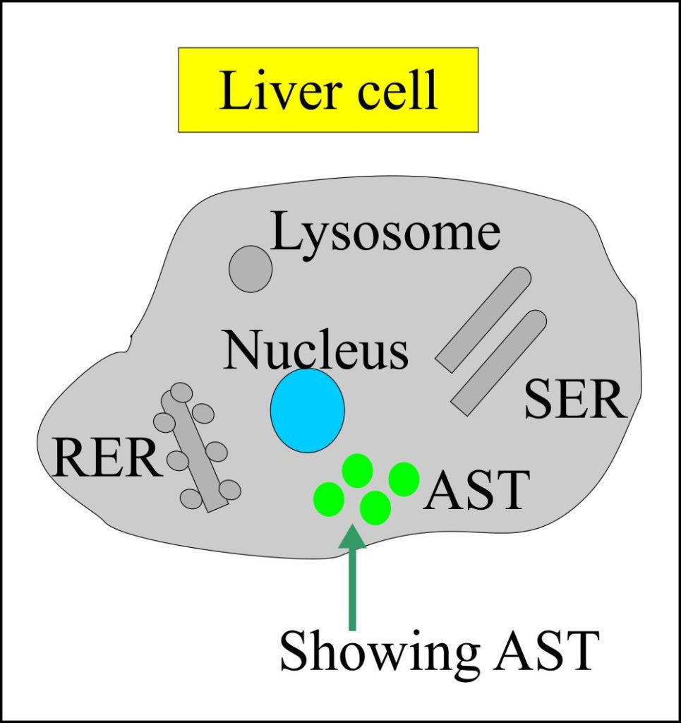 sgot-aspartate-aminotransferase-ast-glutamic-oxaloacetic