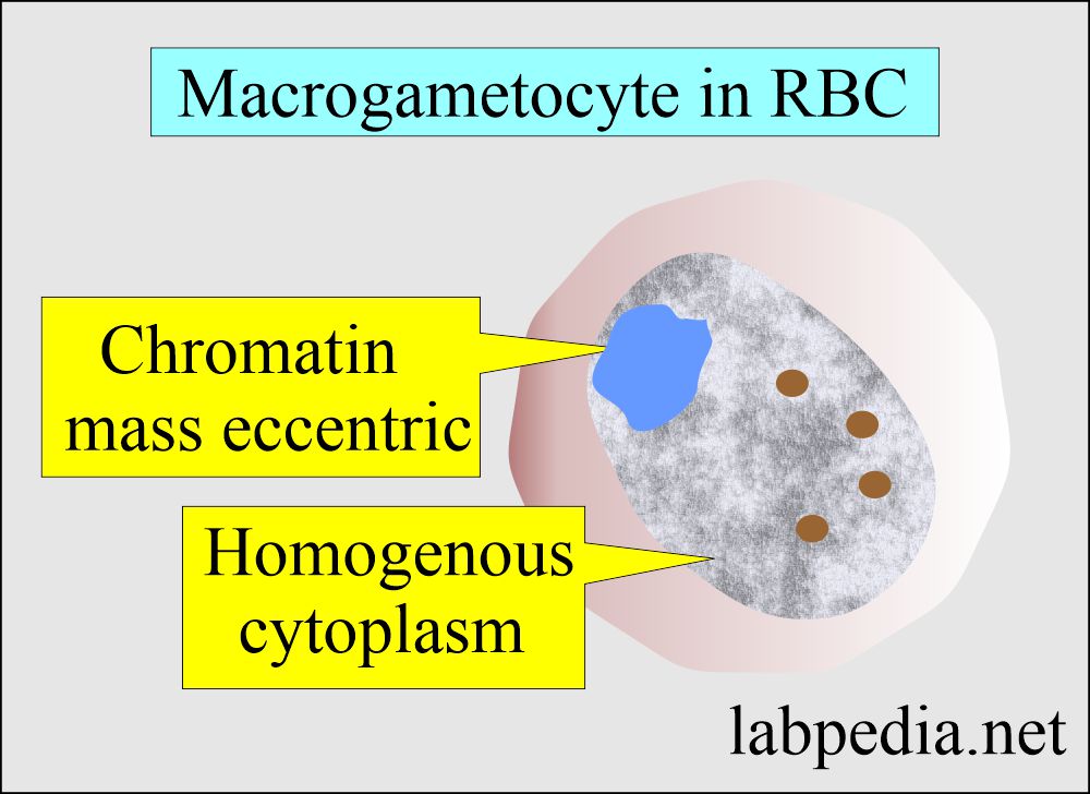 Malarial Parasite macrogametocyte in RBC