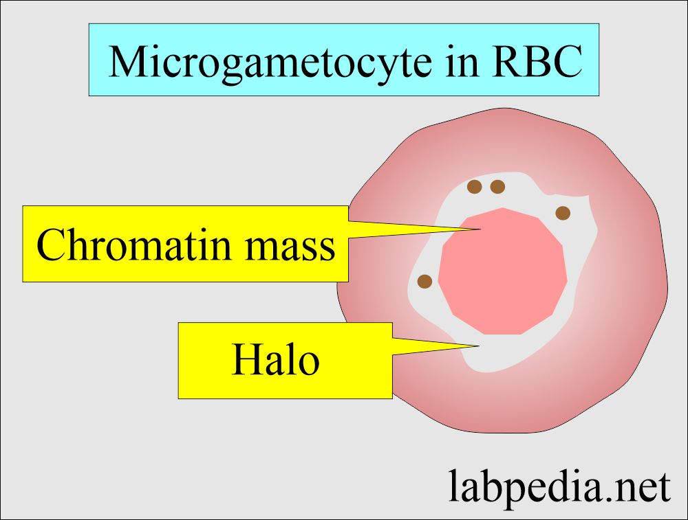 Malarial Parasite microgametocyte in RBC
