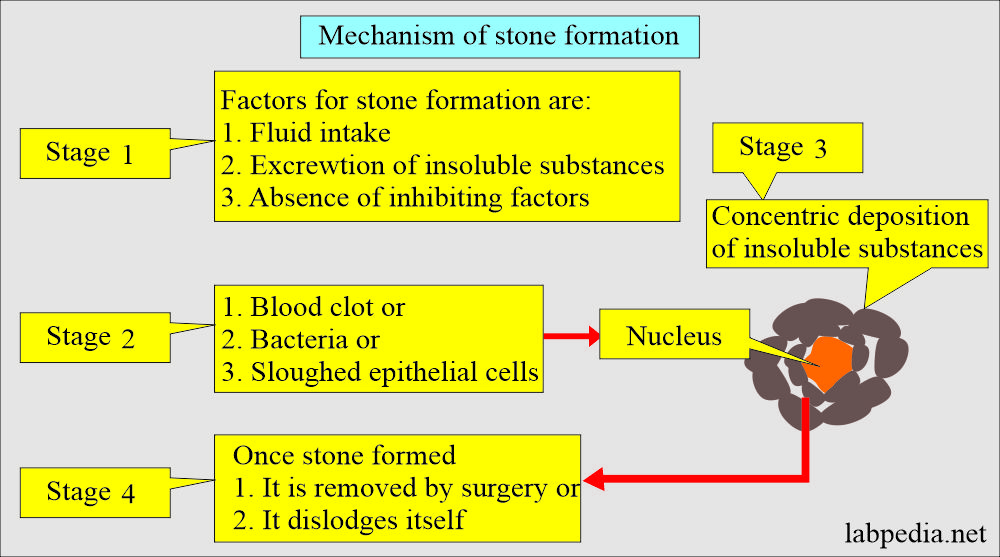 Renal stone analysis: Mechanism of Stone formation