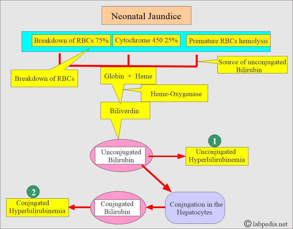 Neonatal jaundice classification Neonatal jaundice classification
