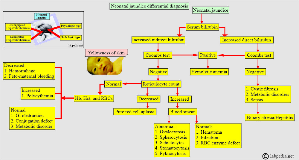 Neonatal jaundice and differential diagnosis Neonatal jaundice and differential diagnosis