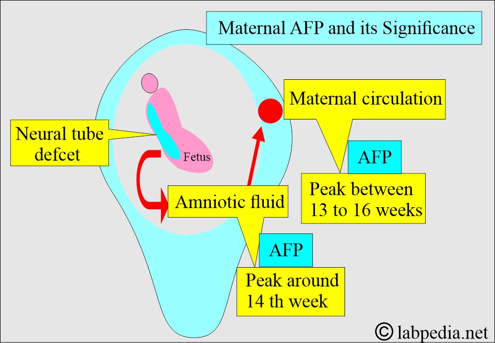 Maternal Alpha-Fetoprotein (AFP): Neural tube defect and AFP Maternal Alpha-Fetoprotein (AFP): Neural tube defect and AFP