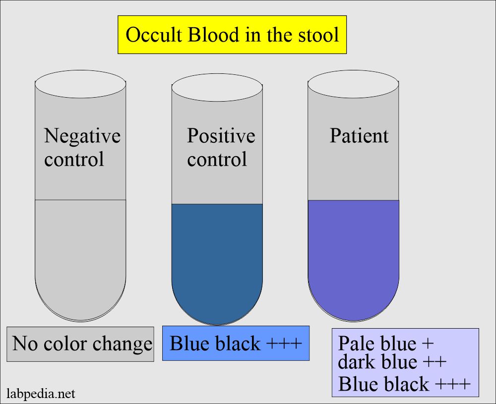Occult blood test result interpretation