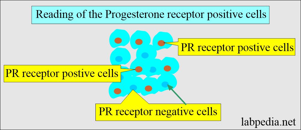 Progesterone (PR) receptor positive cells 