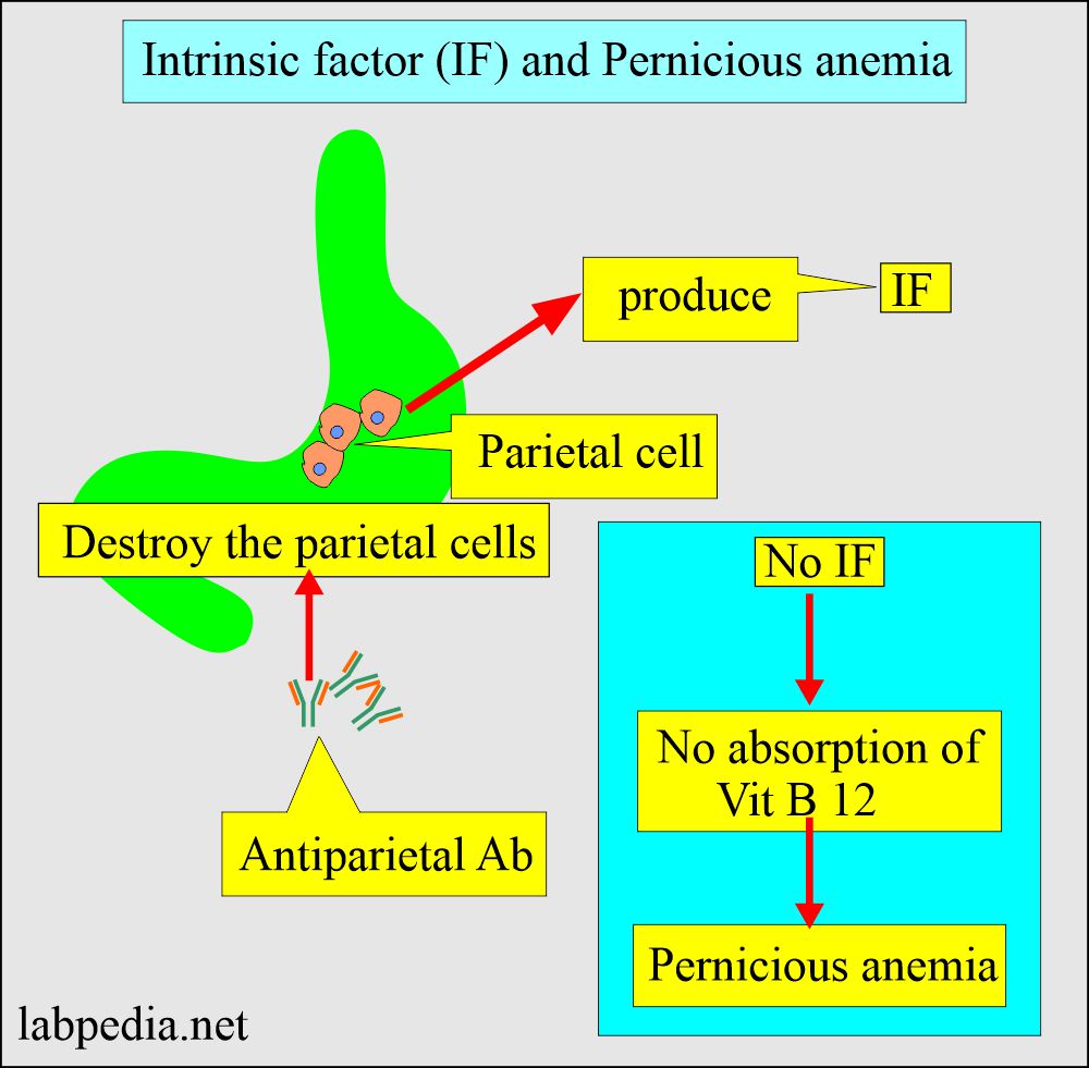 Intrinsic factor Antibody (IF Ab): Intrinsic factor and Pernicious anemia