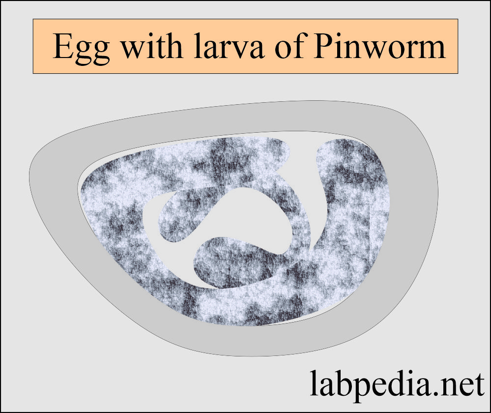 Common parasites: Pinworm egg with larva