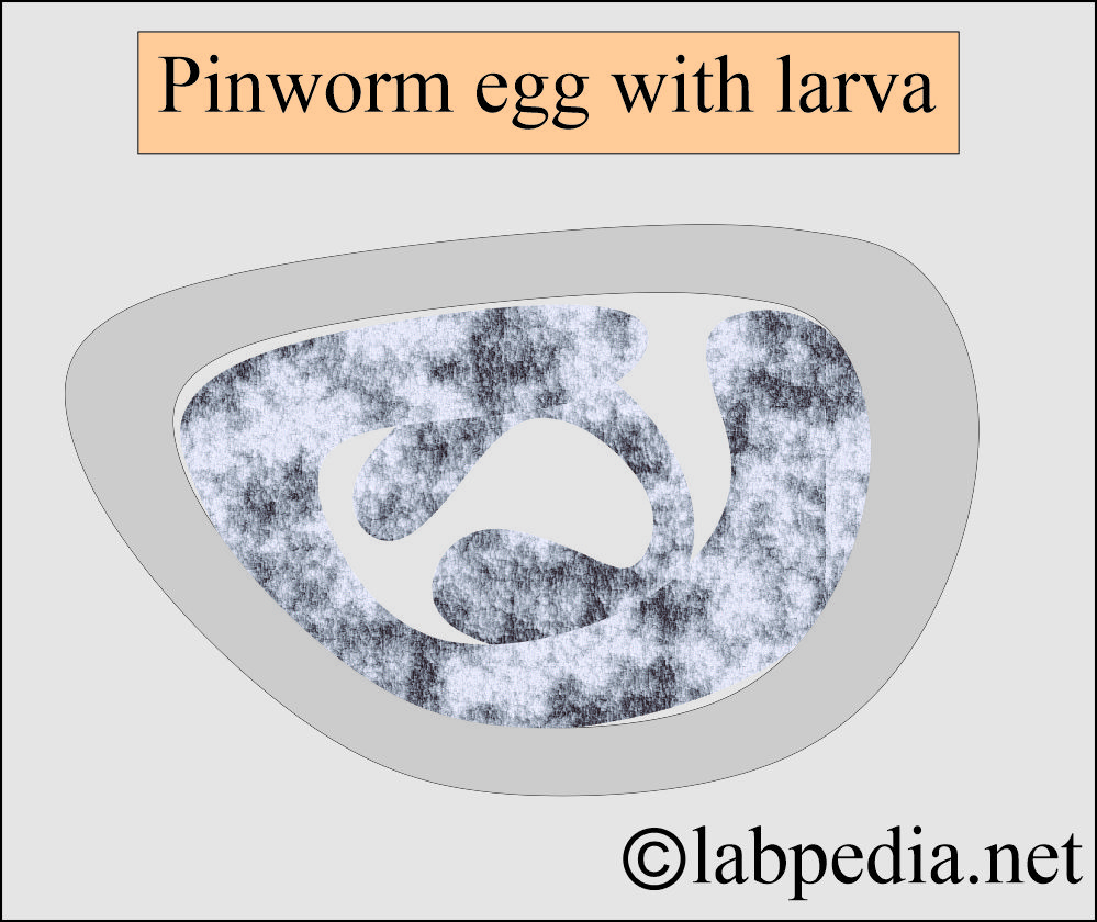 Pinworm egg with larva Pinworm egg with larva