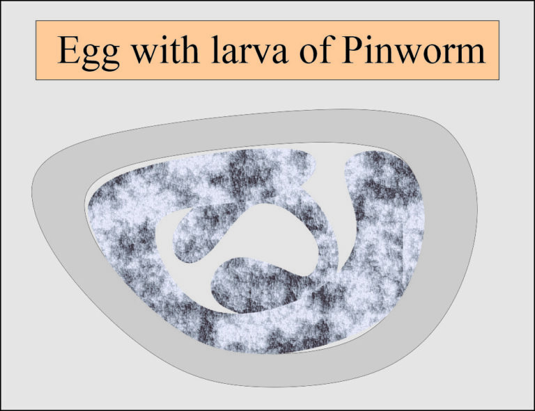 Enterobius Vermicularis (Pinworms), Diagnosis and Treatment