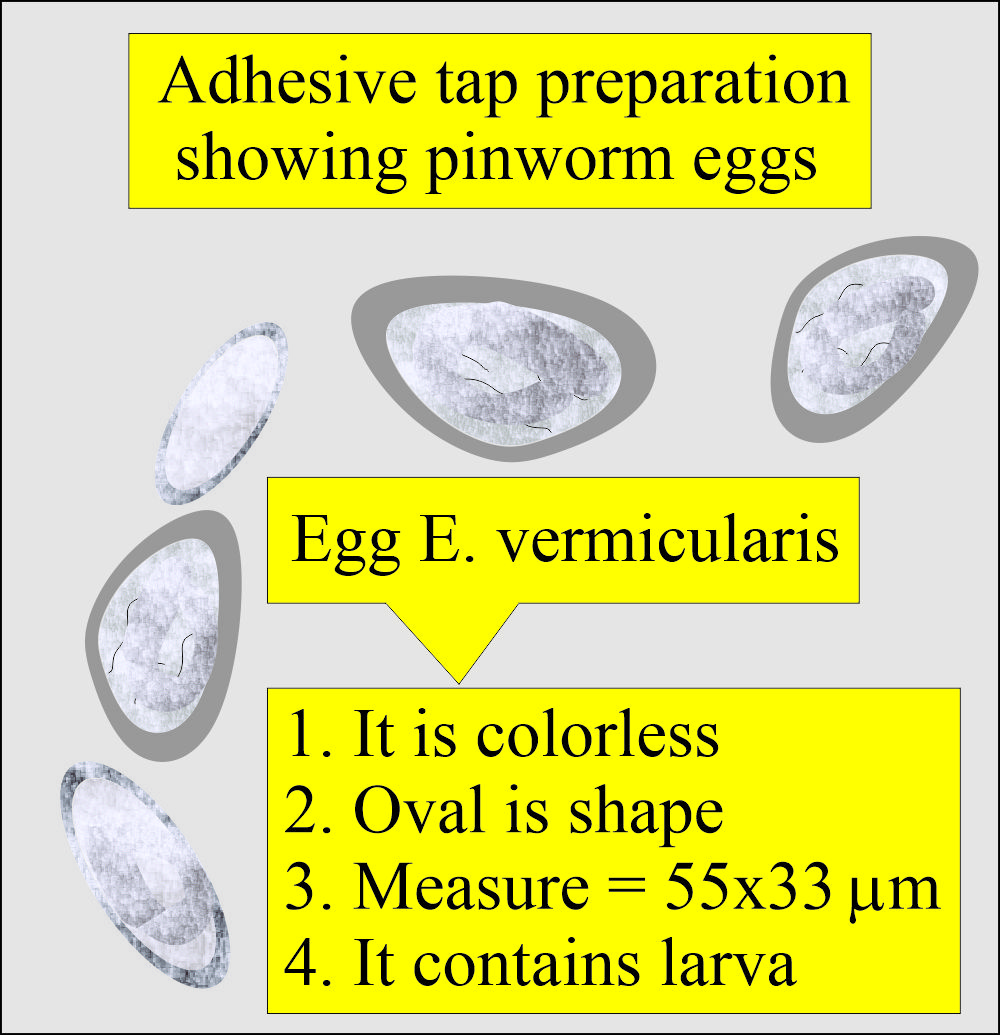 Enterobius vermicularis (Pinworm) eggs