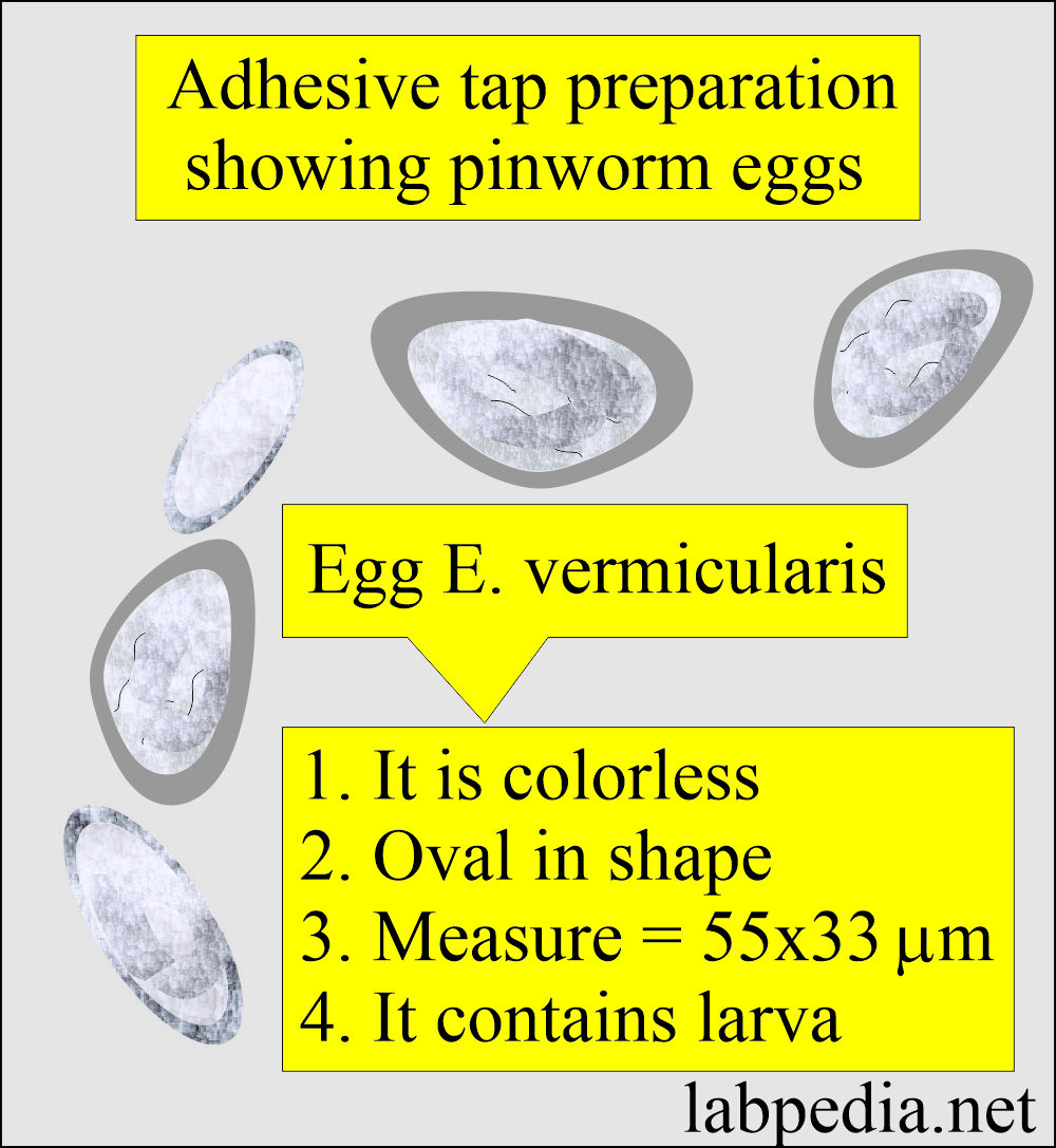 Pinworm seen on tap preparation