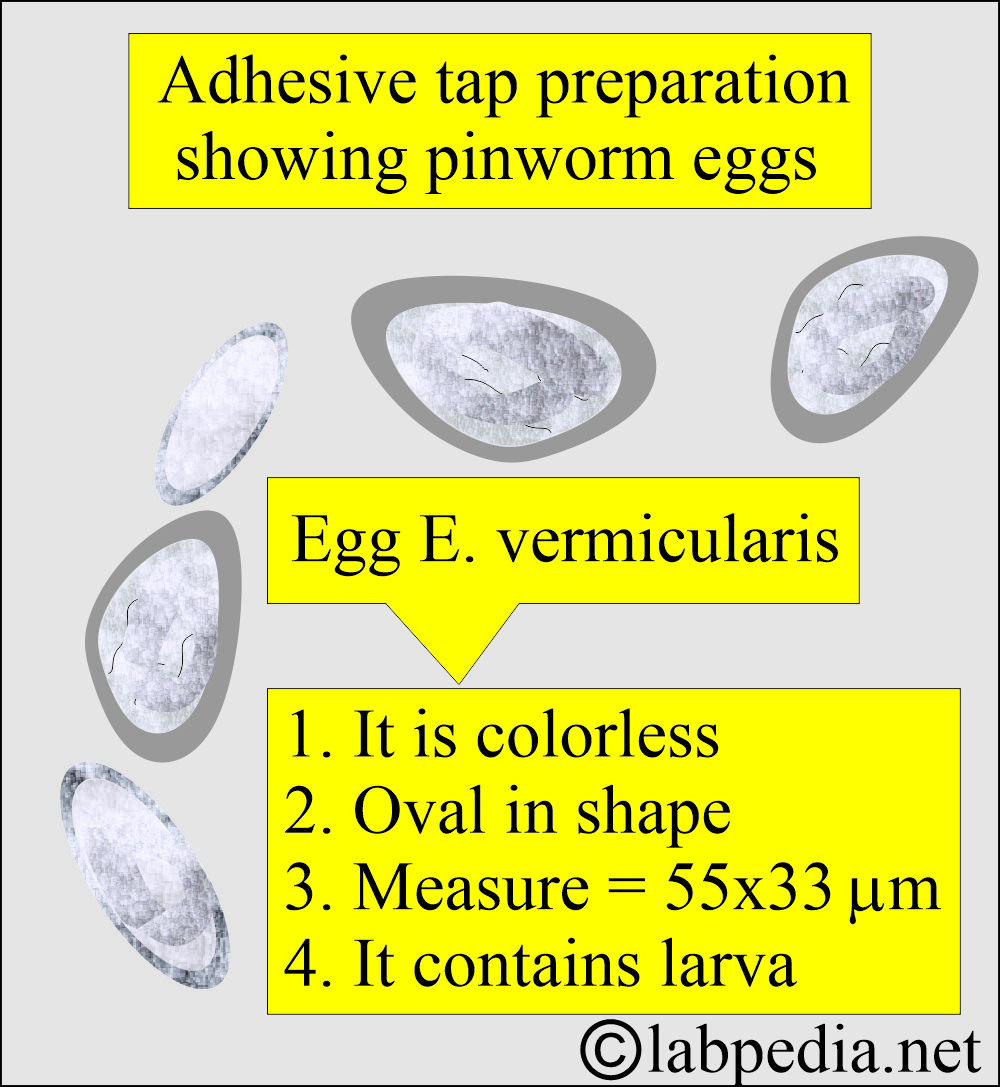 Pinworm seen on tap cellophane eggs Pinworm seen on tap cellophane eggs