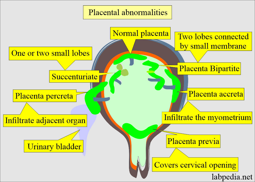 Placental abnormalities