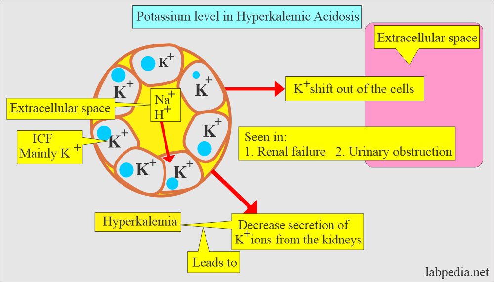 Urine potassium (K+): Potassium (K+) level in acidosis