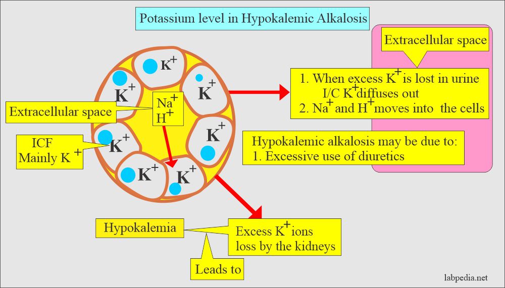 Potassium alkalosis pathogenesis