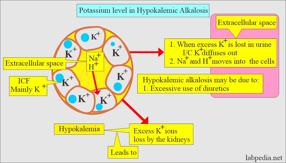 Potassium (K+) control in alkalosis