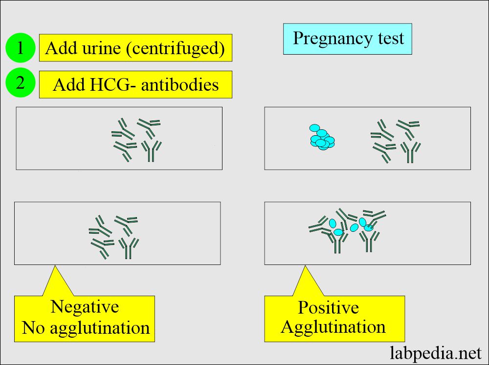 Beta-HCG Level: Pregnancy agglutination test