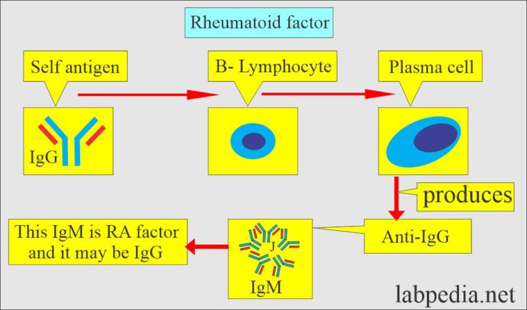 Rheumatoid Factor (RF), Rheumatoid Arthritis (RA factor) - Labpedia.net