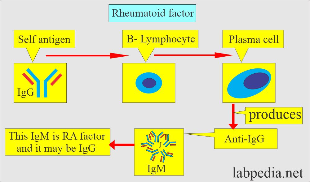 Mechanism of Rheumatoid factor (RA)
