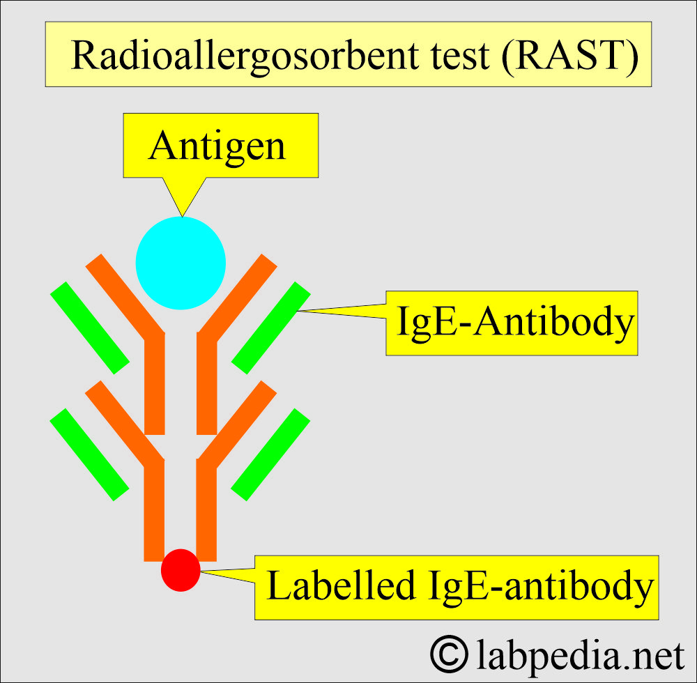 RAST test for to detect IgE antibody RAST test for to detect IgE antibody