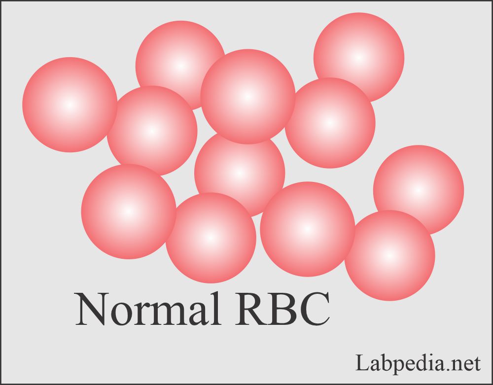 Normal Red blood cells