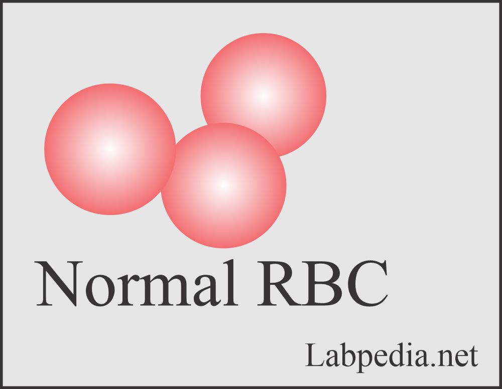 Red Blood Cell (RBC):- Part 2 – Peripheral blood smear, Normal Picture and RBC Morphology