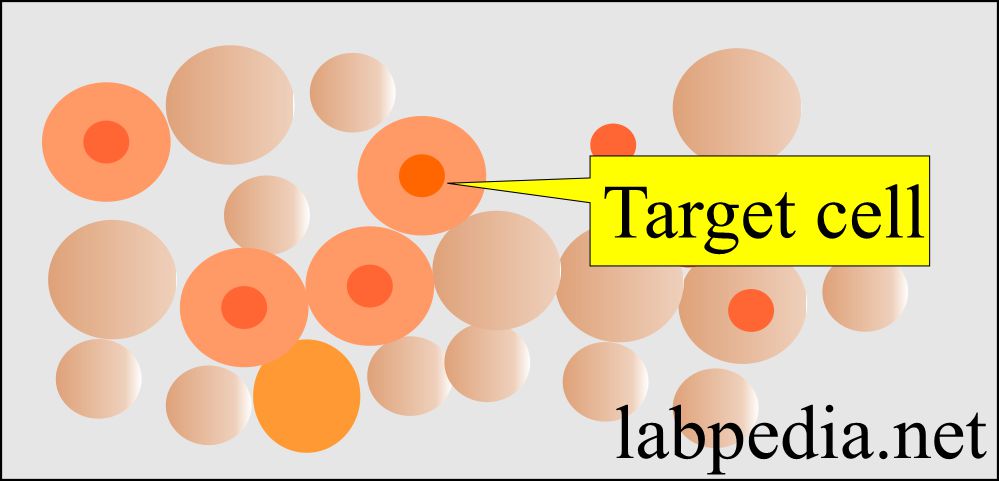 Peripheral blood smear: RBC target cells