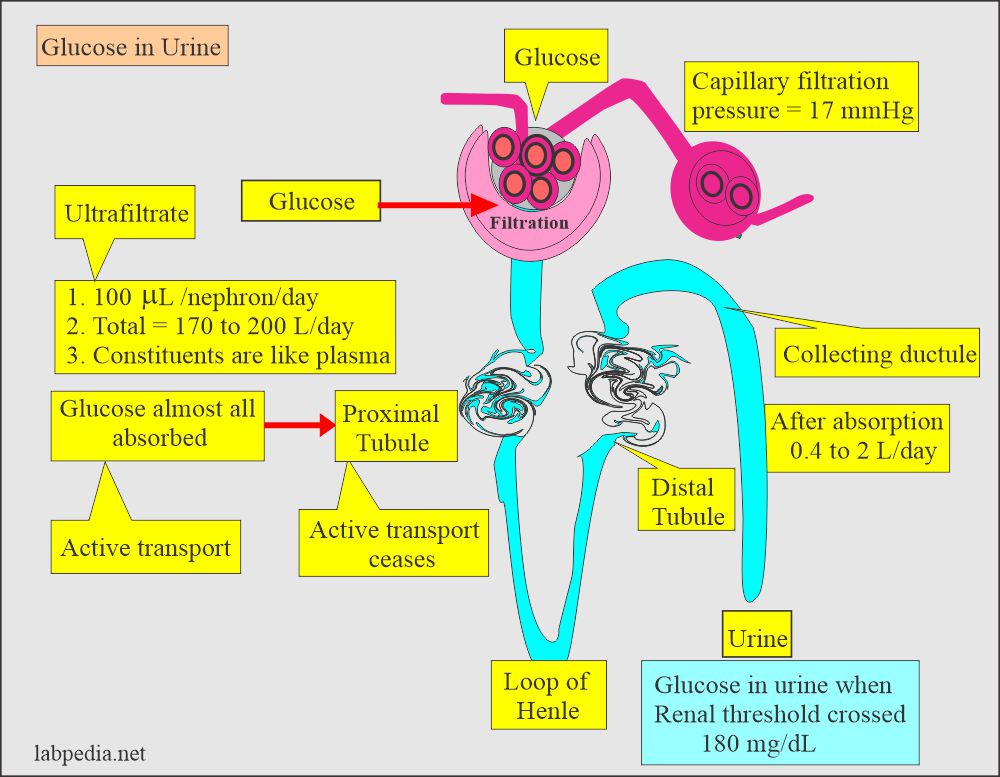 Diabetes Mellitus:- Part 5 – Glucose in Urine (Glycosuria), Urine Sugar, Benedict’s solution