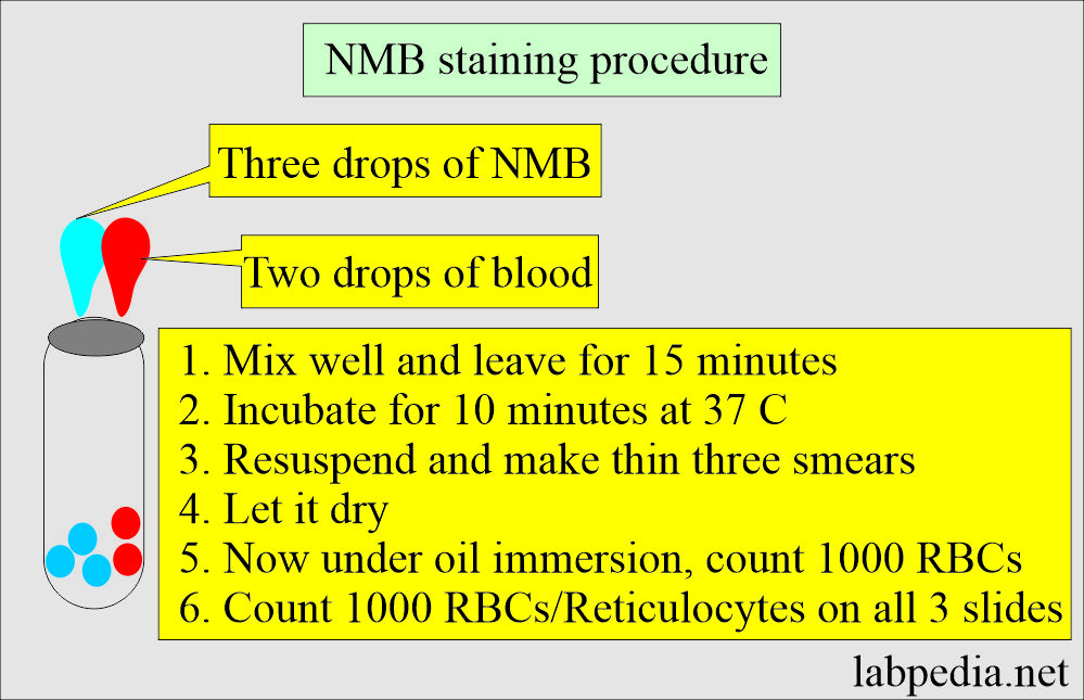 Reticulocyte NMB stain procedure summary