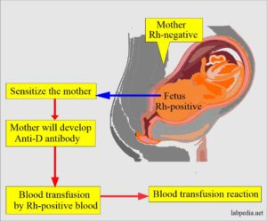 Hemolytic Disease Of Newborn (HDN), And Coombs Test