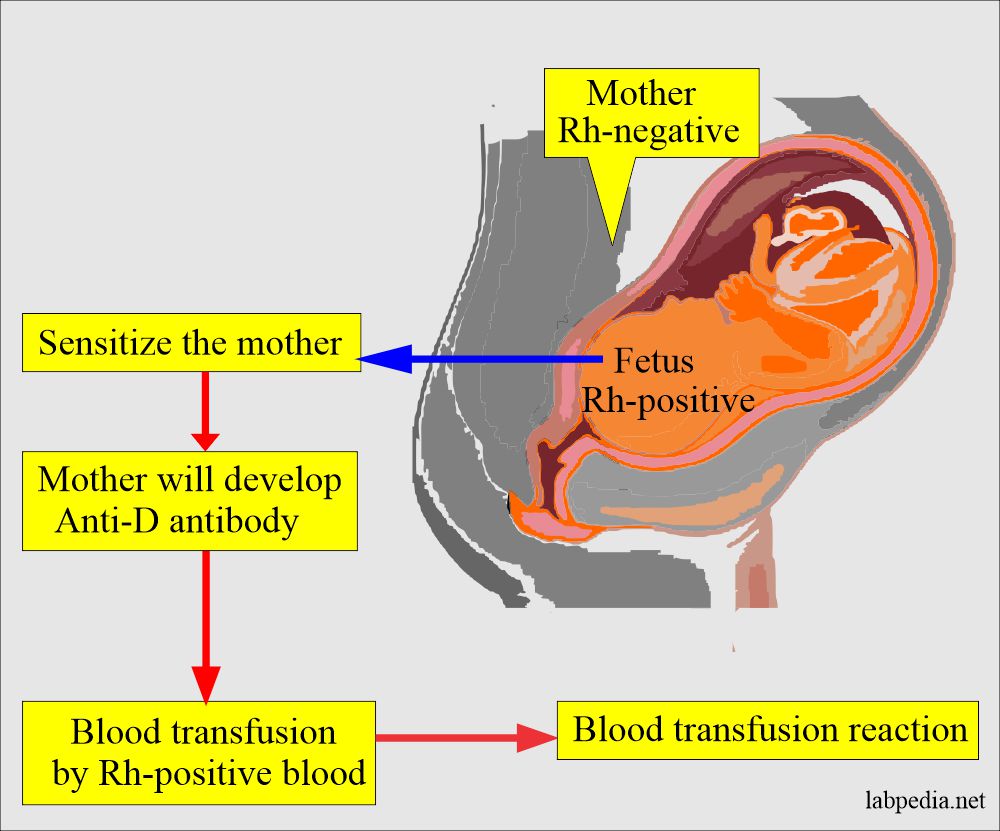 Sensitization of the mother by Rh+ fetus