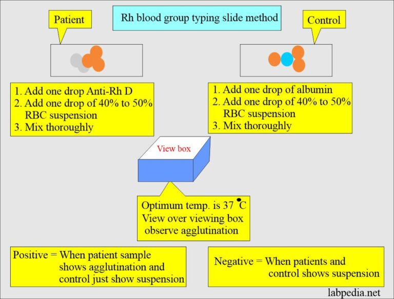 Blood Banking:- Part 1- Blood Groups ABO And Rh System, Blood Grouping ...